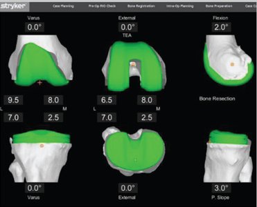 Total Knee logo